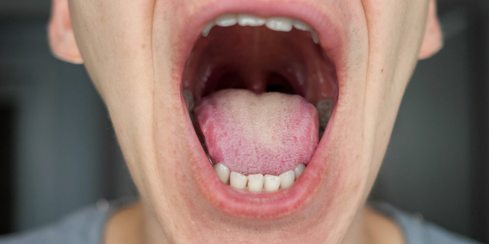 What Your Tongue Can Tell You About Your Overall Health Rockland Dental Specialists