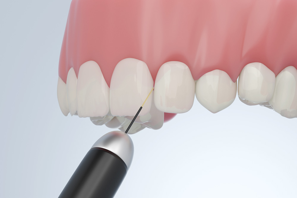 The Role of Biopsy in Oral Surgery - Diagnosing Pathological Conditions